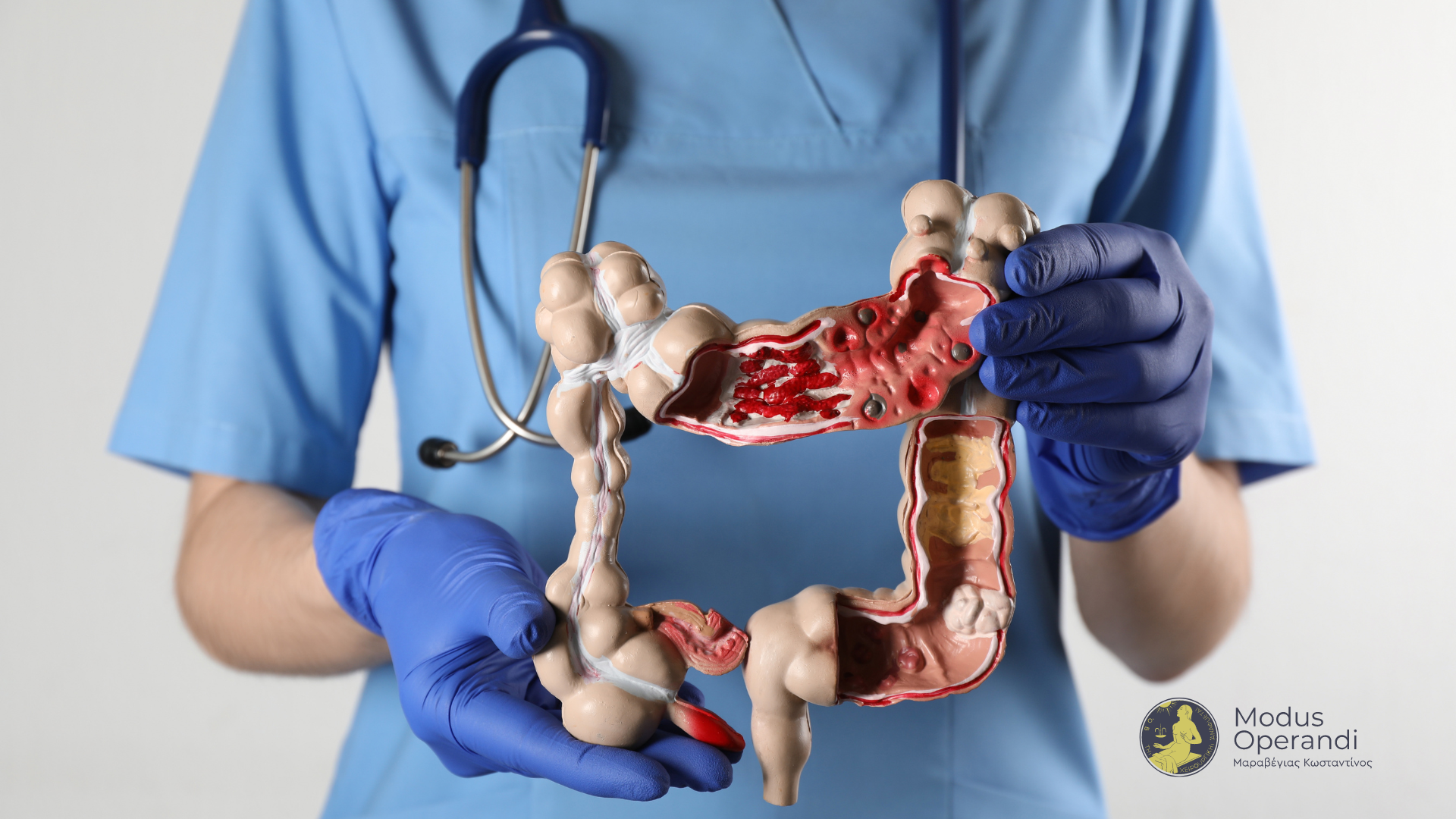 καρκίνος του παχέος εντέρου doctor with colon image